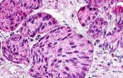 GPR21 Antibody, Novus Biologicals 50 &mu;g | Buy Online | Novus Biologicals | Fisher Scientific